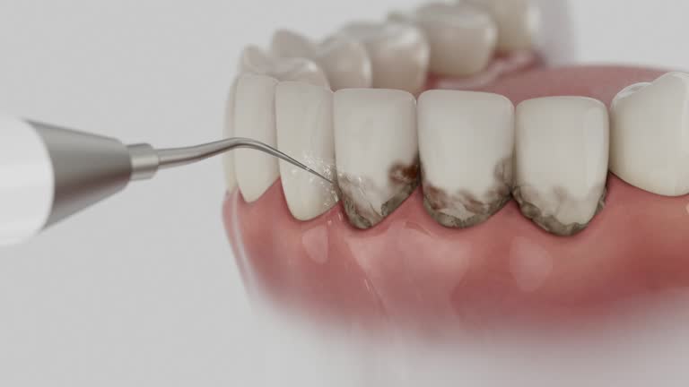 Trusted Teeth Cleaning And Checkup service in Escatawpa, MS - Dentist Open Now